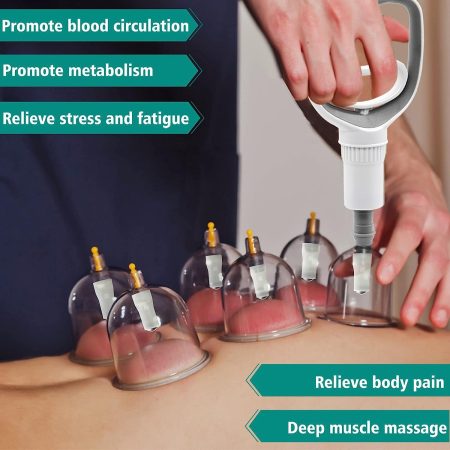 cupping