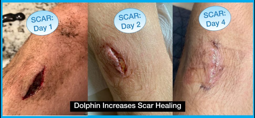 scar healing